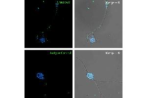 Live Cell Imaging (LCI) image for anti-Glutamate Receptor, Ionotropic, N-Methyl D-Aspartate 1 (GRIN1) (Extracellular), (N-Term) antibody (ABIN7886359) (GRIN1/NMDAR1 Antikörper  (Extracellular, N-Term))