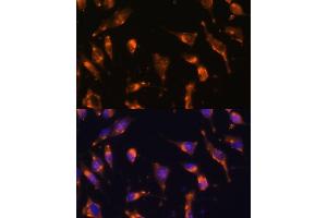 Immunofluorescence analysis of L929 cells using Somatostatin Receptor 2 (SSTR2) Polyclonal Antibody (ABIN7270493) at dilution of 1:100 (40x lens). (SSTR2 Antikörper  (C-Term))