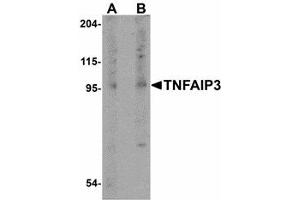 Image no. 1 for anti-Tumor Necrosis Factor, alpha-Induced Protein 3 (TNFAIP3) (Internal Region) antibody (ABIN478080) (TNFAIP3 Antikörper  (Internal Region))