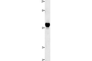 Western Blotting (WB) image for anti-Tumor Necrosis Factor Receptor Superfamily, Member 21 (TNFRSF21) antibody (ABIN2425779) (TNFRSF21 Antikörper)