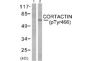 Western blot analysis of extracts from cos-7cells using Cortactin (phospho-Tyr466) antibody (Line 1 and 2). (Cortactin Antikörper  (pTyr466))