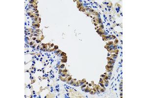 Immunohistochemistry of paraffin-embedded mouse lung using ESD antibody (ABIN5973666) at dilution of 1/100 (40x lens). (Esterase D Antikörper)