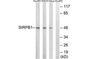 Western blot analysis of extracts from HeLa/COLO/HuvEc cells, using SIRPB1 Antibody. (SIRPB1 Antikörper  (AA 231-280))