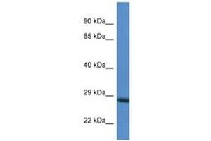 Image no. 1 for anti-RAB6C (WTH3DI) (AA 118-167) antibody (ABIN6746841) (WTH3DI Antikörper  (AA 118-167))