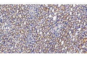 Detection of HIF1a in Rat Kidney Tissue using Polyclonal Antibody to Hypoxia Inducible Factor 1 Alpha (HIF1a) (HIF1A Antikörper  (AA 216-336))