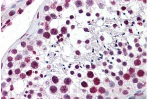 Human Testis: Formalin-Fixed, Paraffin-Embedded (FFPE) (Aryl Hydrocarbon Receptor Antikörper  (AA 279-376))