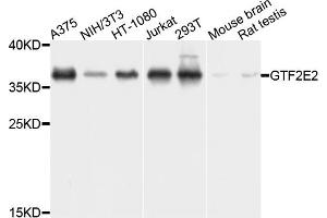 Western blot analysis of extracts of various cell lines, using GTF2E2 antibody. (GTF2E2 Antikörper)