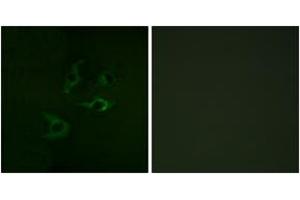 Immunofluorescence analysis of A549 cells, using CBL (Ab-774) Antibody. (CBL Antikörper  (AA 740-789))