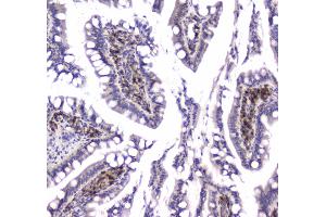 Immunohistochemistry (IHC) image for anti-Glyoxalase I (GLO1) (AA 2-184) antibody (ABIN5692862)