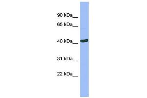 Western Blotting (WB) image for anti-serpin Peptidase Inhibitor, Clade B (Ovalbumin), Member 13 (SERPINB13) (N-Term) antibody (ABIN2775375)