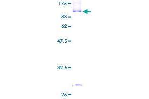 Image no. 1 for Sorting Nexin 9 (SNX9) (AA 1-595) protein (GST tag) (ABIN1320921) (SNX9 Protein (AA 1-595) (GST tag))