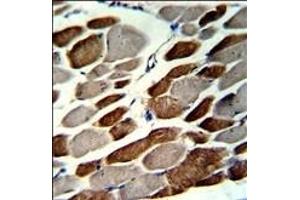 Formalin-fixed and paraffin-embedded human skeletal muscle with EMILIN1 Antibody (N-term), which was peroxidase-conjugated to the secondary antibody, followed by DAB staining. (Emilin1 Antikörper  (N-Term))