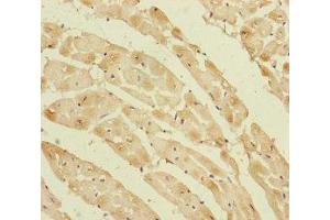 Immunohistochemistry of paraffin-embedded human heart tissue using ABIN7162809 at dilution of 1:100 (PPIF Antikörper  (AA 30-207))