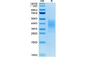 SDS-PAGE (SDS) image for Triggering Receptor Expressed On Myeloid Cells 2 (TREM2) (AA 19-171) protein (His tag) (ABIN7275791)