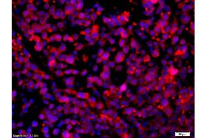 Formalin-fixed and paraffin-embedded mouse intestine carcinoma with Anti-CCR5/CD195 Polyclonal Antibody, Unconjugated (ABIN741375) 1:200, overnight at 4°C, The secondary antibody was Goat Anti-Rabbit IgG, Cy3 conjugated used at 1:200 dilution for 40 minutes at 37°C. (CCR5 Antikörper  (AA 201-300))
