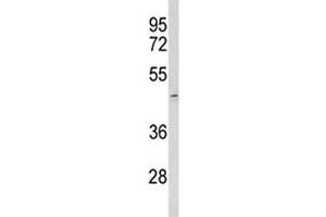 Western blot analysis of ACR antibody and human T47D lysate. (Acrosin Antikörper  (AA 99-127))