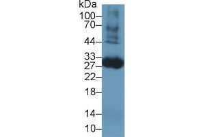 Western blot analysis of Rat Blood Cells lysate, using Rat TF Antibody (1 µg/ml) and HRP-conjugated Goat Anti-Rabbit antibody ( (Tissue factor Antikörper  (AA 30-252))