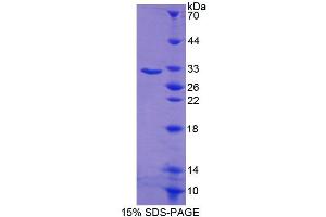 SDS-PAGE (SDS) image for C-terminal Binding Protein 1 (CTBP1) (AA 1-250) protein (His tag) (ABIN6238970)