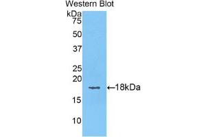 Western blot analysis of the recombinant protein. (KRT6A Antikörper  (AA 323-461))