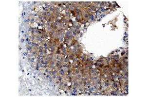 IHC analysis of GSDMD using anti-GSDMD antibody (ABIN7599432). (GSDMD Antikörper  (AA 1-484))