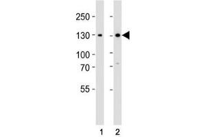 Western blot analysis of lysate from (1) 293 and (2) Jurkat cell line using GLI2 antibody at 1:1000. (GLI2 Antikörper  (C-Term))