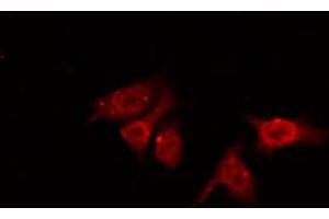 ABIN6267468 staining NIH-3T3 by IF/ICC. (CDC25B Antikörper  (pSer353))