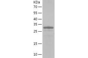 Western Blotting (WB) image for Sorbin and SH3 Domain Containing 3 (Sorbs3) (AA 1-329) protein (His tag) (ABIN7125173) (Vinexin Protein (AA 1-329) (His tag))