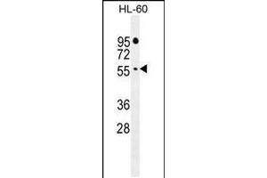 Western blot analysis in HL-60 cell line lysates (35ug/lane). (FBXW11 Antikörper  (AA 168-196))