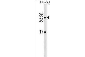 Western Blotting (WB) image for anti-Lymphotoxin beta (TNF Superfamily, Member 3) (LTB) antibody (ABIN2995416)
