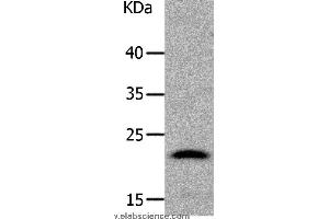 Western blot analysis of Human liver cancer tissue, using LCN2 Polyclonal Antibody at dilution of 1:1050 (Lipocalin 2 Antikörper)