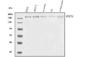 Western blot analysis of PCF11 using anti-PCF11 antibody (ABIN7599844).