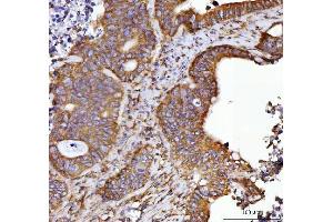 IHC analysis of Septin 2/SEPTIN2 using anti-Septin 2/SEPTIN2 antibody (ABIN7599275). (Septin 2 Antikörper  (AA 1-326))