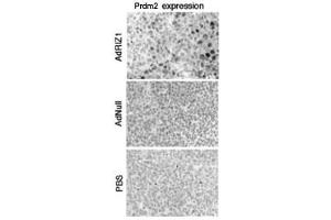 Immunocytochemical analysis of Prdm2 in adenovirus-transduced tumor cells. (PRDM2 Antikörper  (AA 245-573))