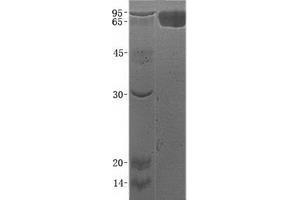 Validation with Western Blot (CD93 Protein (CD93) (His tag))