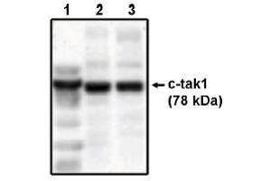 Image no. 1 for anti-MAP/microtubule Affinity-Regulating Kinase 3 (MARK3) antibody (ABIN264979) (MARK3 Antikörper)