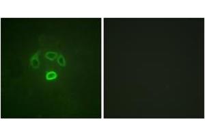 Immunofluorescence analysis of HepG2 cells, using GRB10 (Phospho-Tyr67) Antibody. (GRB10 Antikörper  (pTyr67))