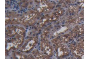 IHC-P analysis of Pig Kidney Tissue, with DAB staining. (FTH1 Antikörper  (AA 1-181))