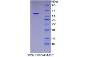 SDS-PAGE analysis of Human Keratin 15 Protein. (KRT15 Protein)