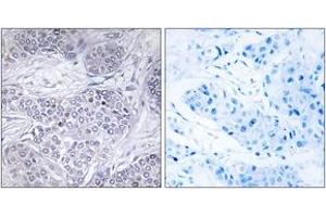 Immunohistochemistry (IHC) image for anti-CCAAT/enhancer Binding Protein (C/EBP), gamma (CEBPG) (AA 31-80) antibody (ABIN1533777)