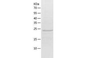 Western Blotting (WB) image for C1q and Tumor Necrosis Factor Related Protein 5 (C1QTNF5) (AA 16-243) protein (His-IF2DI Tag) (ABIN7122068)