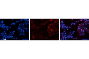 Rabbit Anti-GPX3 Antibody     Formalin Fixed Paraffin Embedded Tissue: Human Lung Tissue  Observed Staining: Membrane and cytoplasmic in alveolar type I & II cells  Primary Antibody Concentration: 1:100  Other Working Concentrations: 1/600  Secondary Antibody: Donkey anti-Rabbit-Cy3  Secondary Antibody Concentration: 1:200  Magnification: 20X  Exposure Time: 0.
