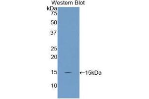 Western Blotting (WB) image for anti-Uncoupling Protein 2 (Mitochondrial, Proton Carrier) (UCP2) (AA 99-216) antibody (ABIN1175764) (UCP2 Antikörper  (AA 99-216))