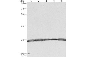 Western blot analysis of Hela, 293T and MCF7 cell, human fetal brain tissue and Jurkat cell, using PRDX3 Polyclonal Antibody at dilution of 1:800 (Peroxiredoxin 3 Antikörper)