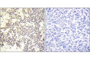 Immunohistochemistry analysis of paraffin-embedded human tonsil, using Neutrophil Cytosol Factor 1 (Phospho-Ser328) Antibody. (NCF1 Antikörper  (pSer328))