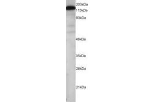 Image no. 1 for anti-Maternal Embryonic Leucine Zipper Kinase (MELK) (AA 639-651) antibody (ABIN290640)