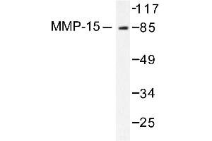 Image no. 1 for anti-Matrix Metallopeptidase 15 (Membrane-inserted) (MMP15) antibody (ABIN265526) (MMP15 Antikörper)