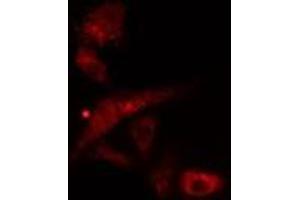 ABIN6277078 staining  Hela cells by IF/ICC. (LYN Antikörper  (C-Term))