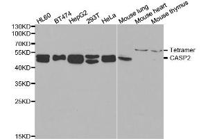 Western blot analysis of extracts of various cell lines, using CASP2 antibody. (Caspase 2 Antikörper)