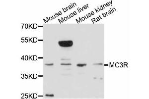 Western blot analysis of extracts of various cell lines, using MC3R antibody (ABIN4904319) at 1:3000 dilution. (MC3R Antikörper)