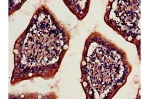 Immunohistochemistry (IHC) image for anti-Dipeptidyl-Peptidase 4 (DPP4) (AA 473-588) antibody (ABIN7149984)